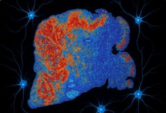 Visualización conceptual del análisis de imágenes biomédicas con inteligencia artificial los mapas de calor permiten señalar las zonas que el algoritmo considera más relevantes dentro de una muestra.