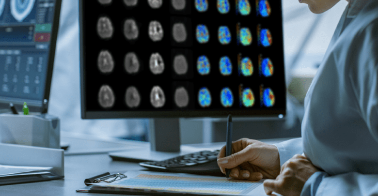 Argentina ya utiliza inteligencia artificial para el diagnóstico y tratamiento de ACV