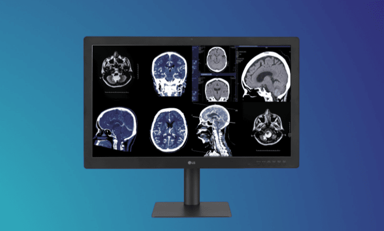 LG presenta su nuevo monitor IPS Black que ofrece calidad de imagen más definida LG presenta su nuevo monitor IPS Black que ofrece calidad de imagen más definida